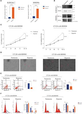 Unveiling the role of hypoxic macrophage-derived exosomes in driving colorectal cancer progression